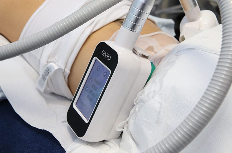 Fat Freezing Body Treatment