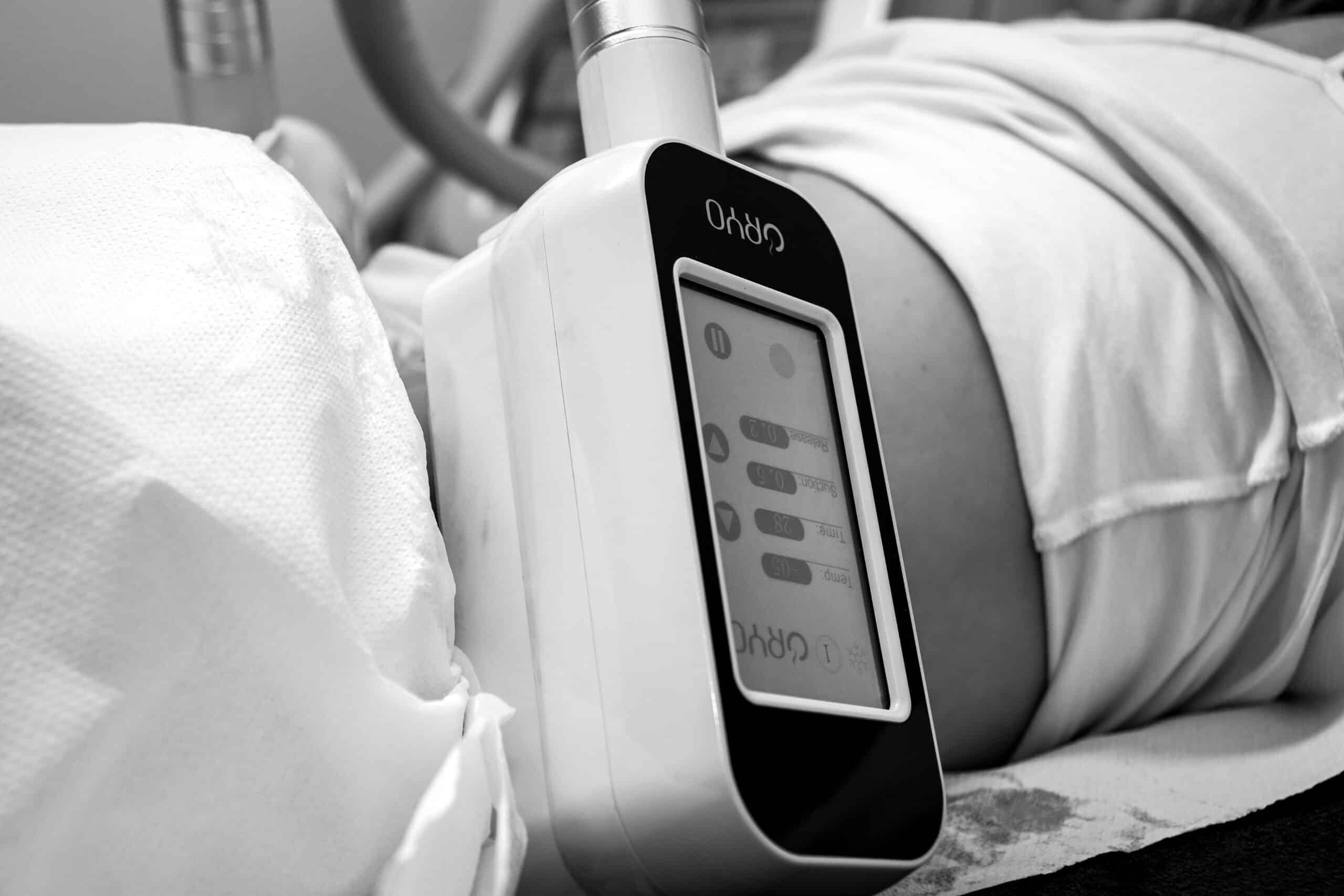 HOW TO SPEED UP HEALING FROM CRYOTHERAPY