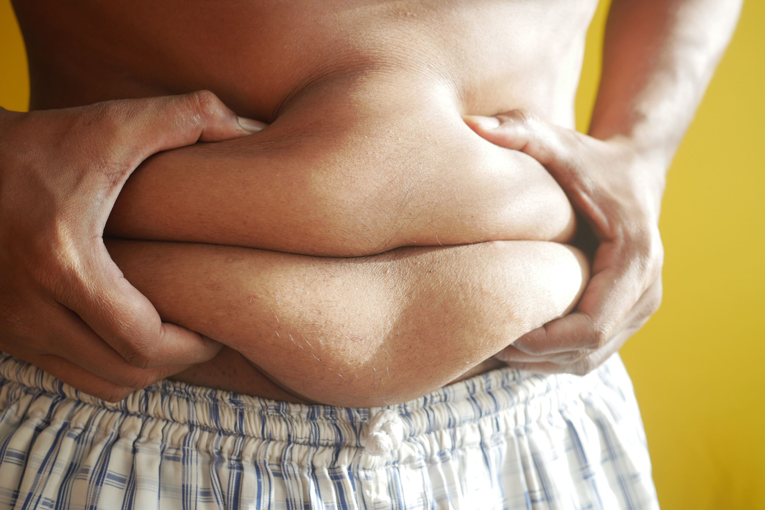 Treatments for excessive fat
