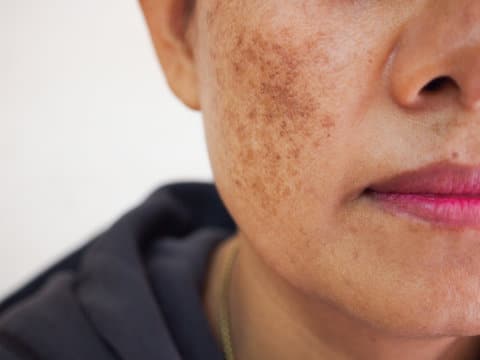 Benefits of skin health