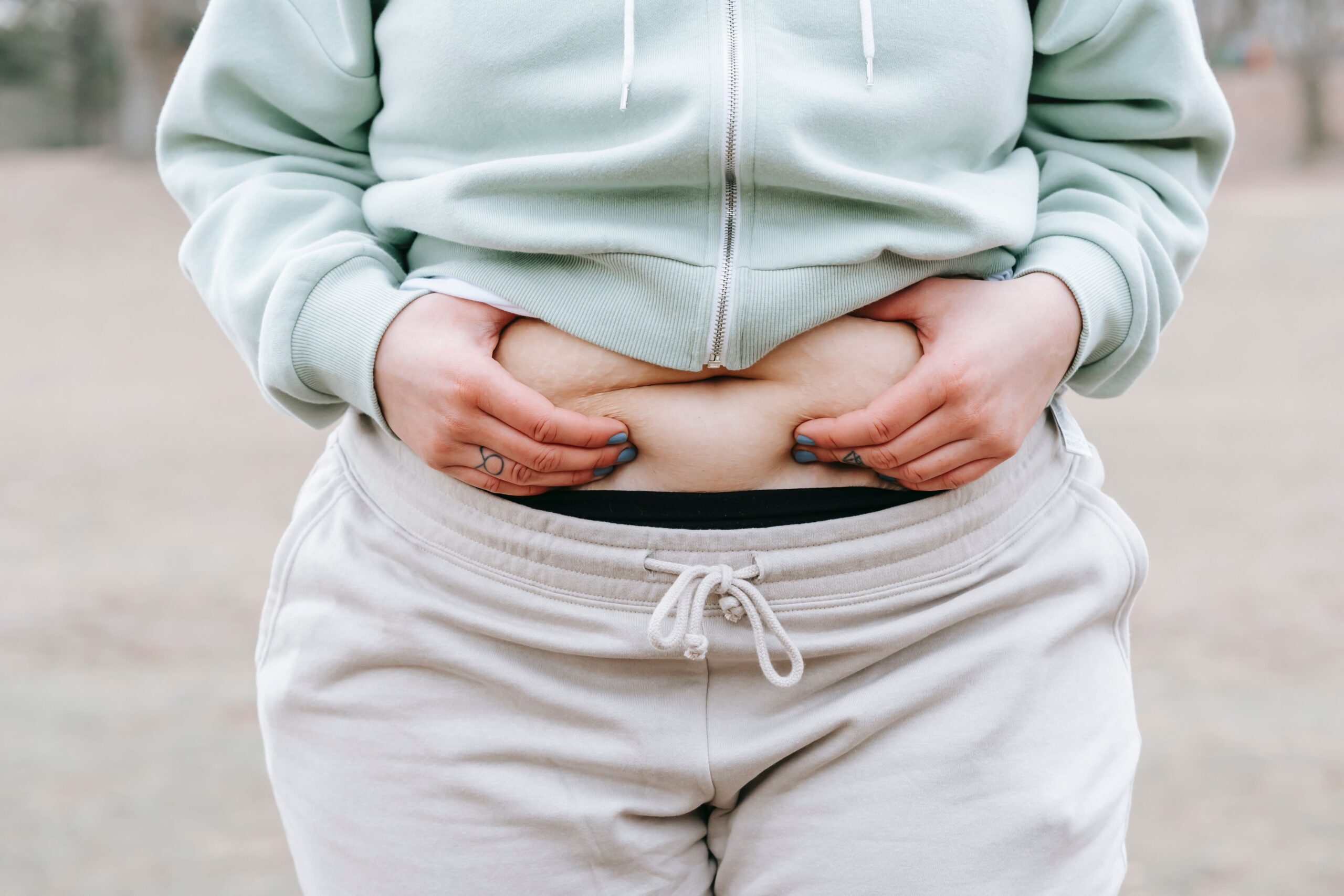 Why Choose Cryolipolysis in Sussex?