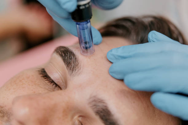 Non-Surgical Face Lifts