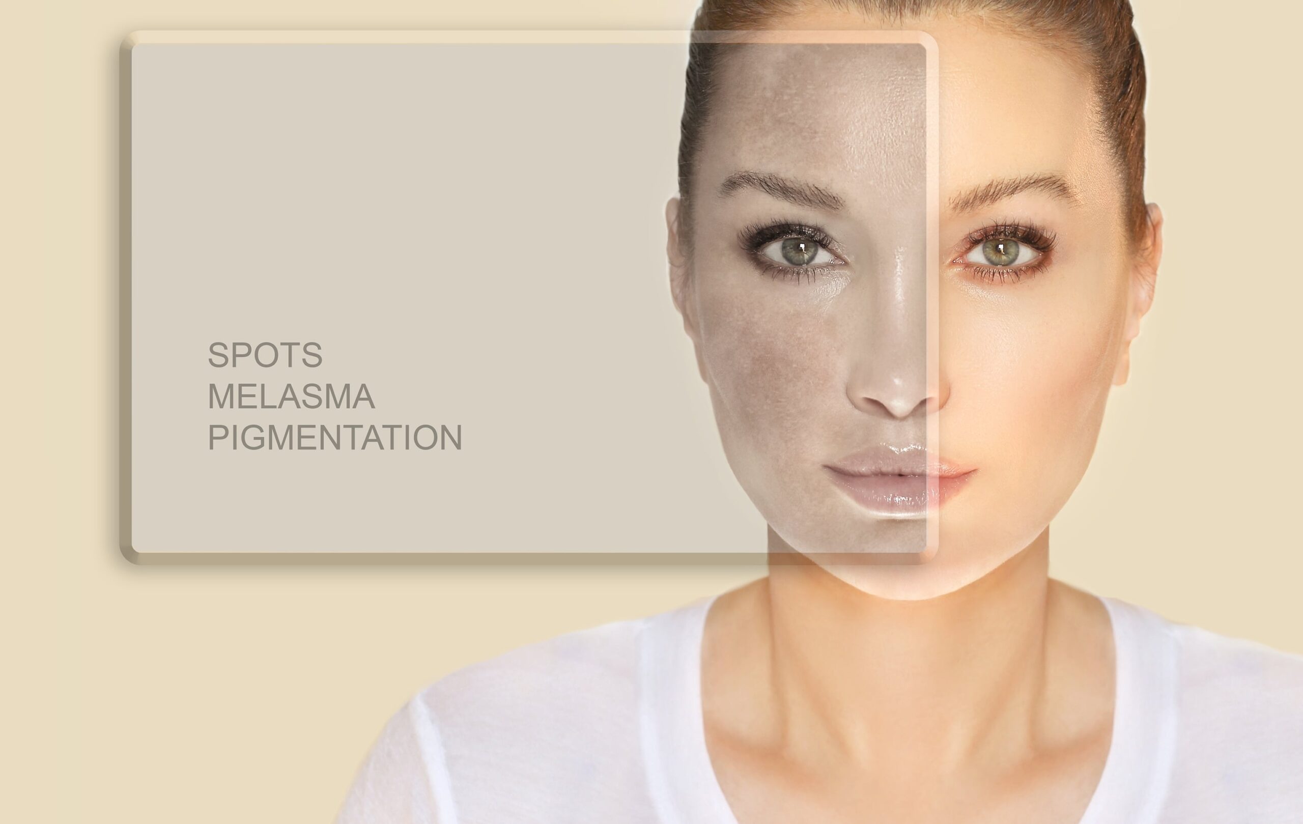 BEFORE AND AFTER SKIN TIGHTENING & WRINKLE TREATMENT