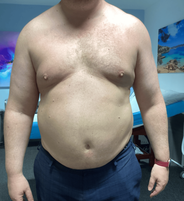 Before