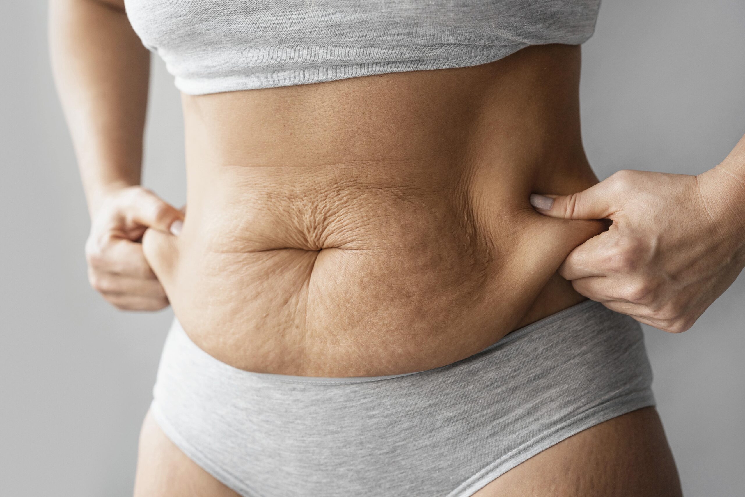 What is a good candidate for fat freezing?