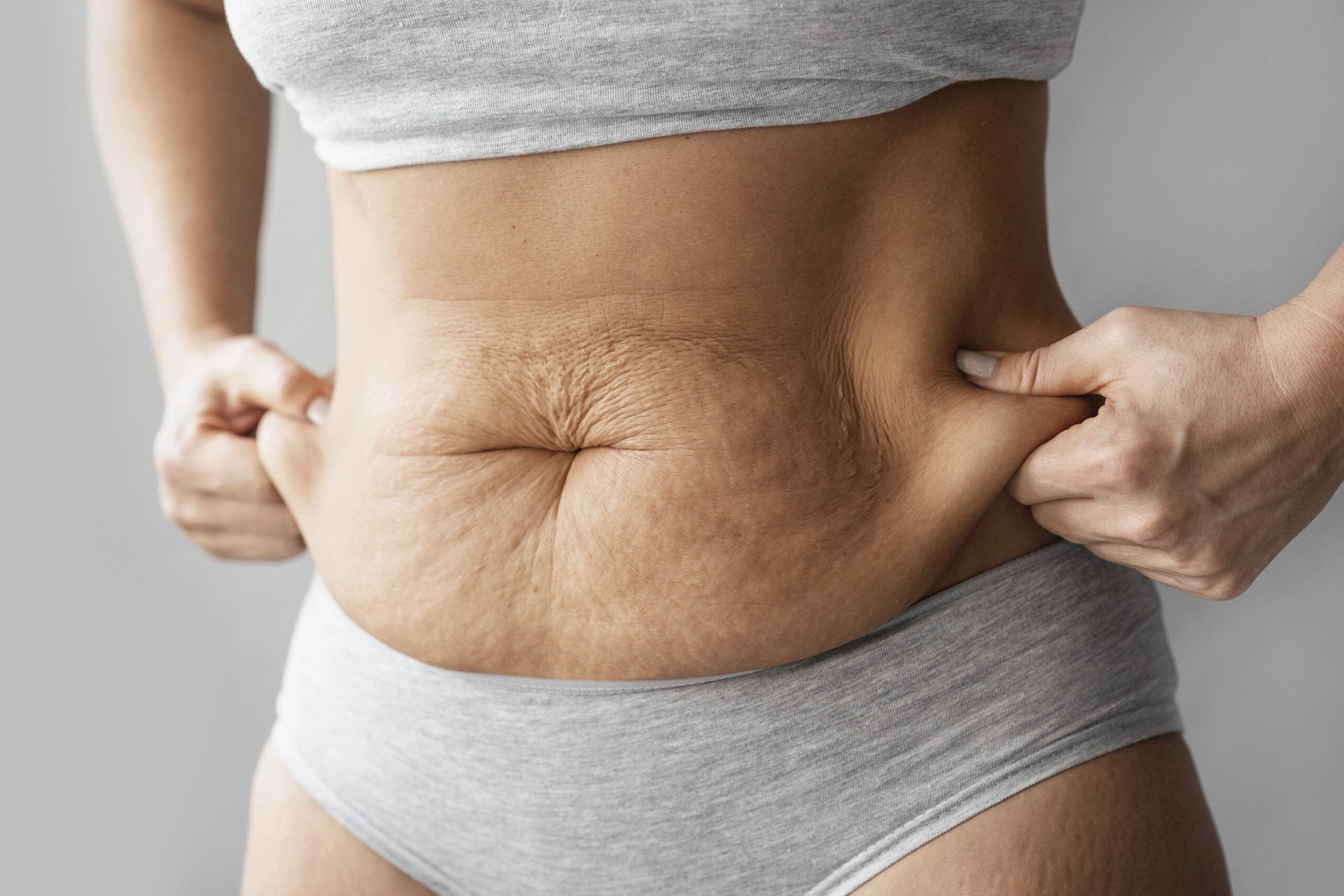 Fat freezing