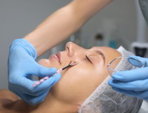 What Is a Chemical Peel? Types, Benefits and What to Expect