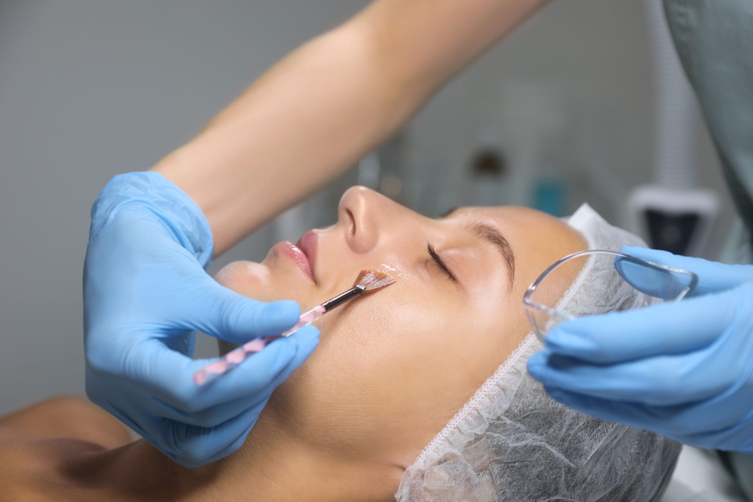 BEFORE AND AFTER SKIN TIGHTENING & WRINKLE TREATMENT