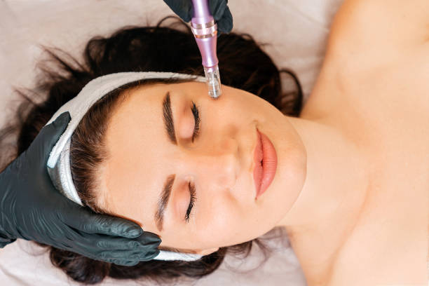istockphoto-1327412888-612×612 Microneedling Pen