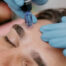 Non-Surgical Face Lifts