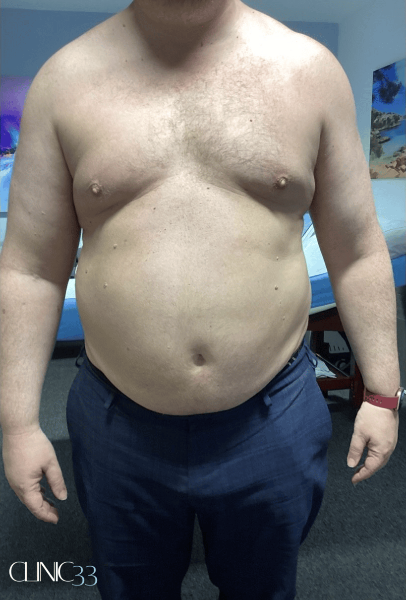 BA-cryo-stomach-2 1