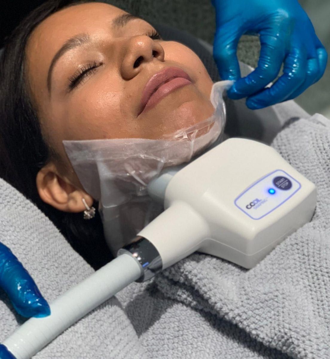 BEFORE AND AFTER SKIN TIGHTENING & WRINKLE TREATMENT