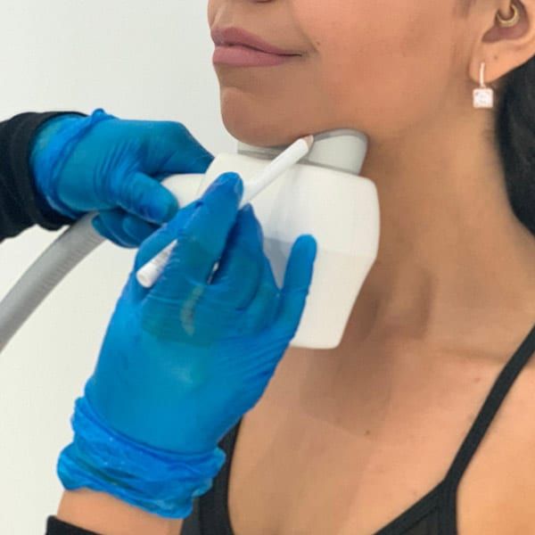 How to tighten skin?