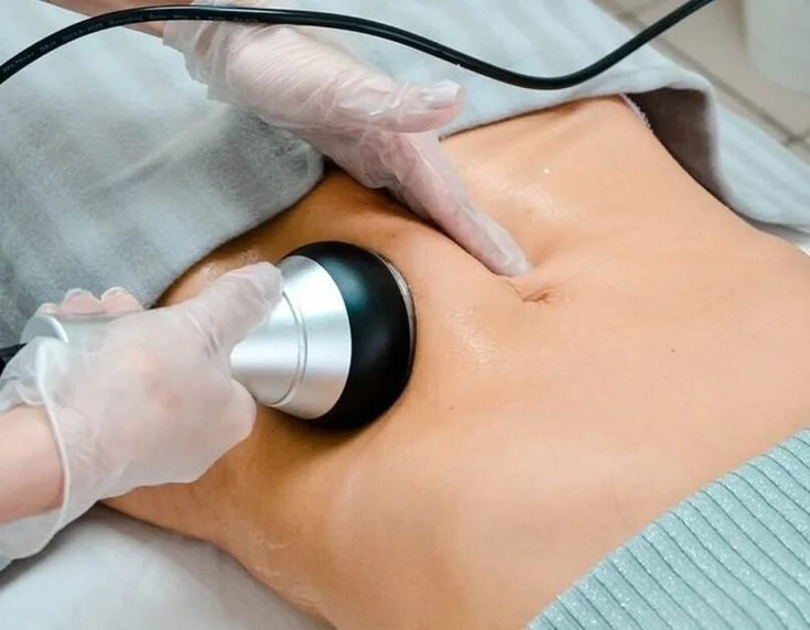 fat freezing results