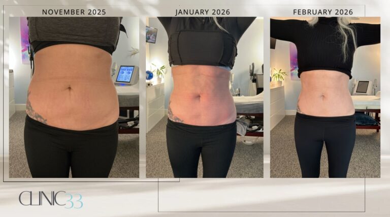 Progression of body transformation over 3 months