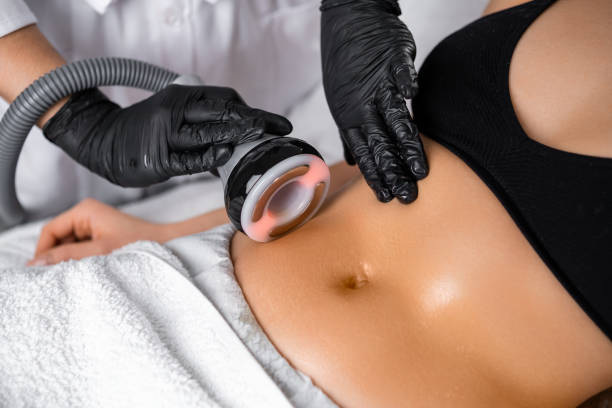 body contouring body contouring