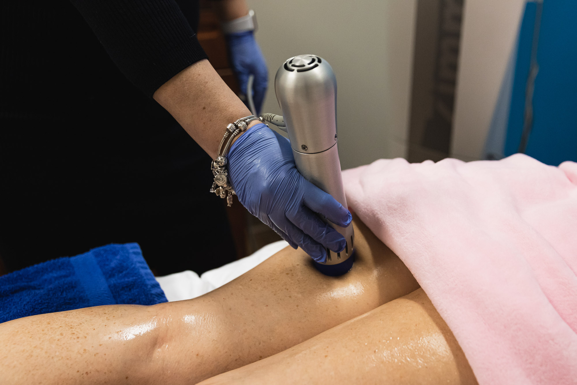cellulite treatment
