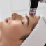 microneedling
