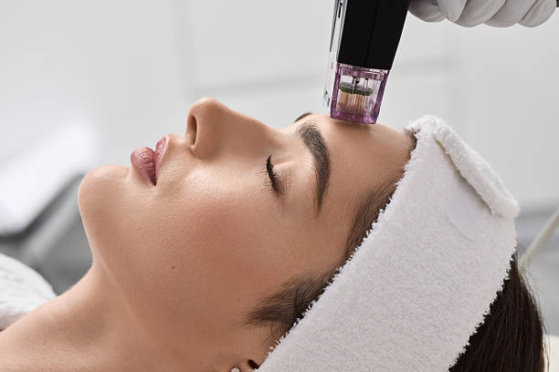 microneedling