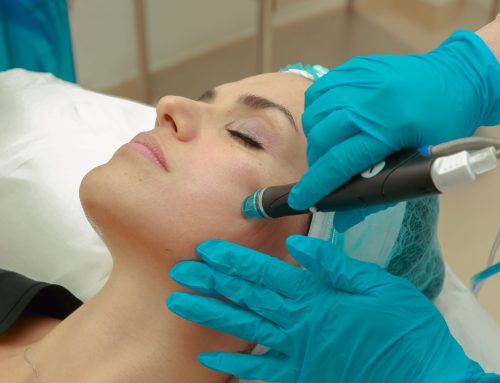 What Is a HydraFacial? Benefits and What to Expect